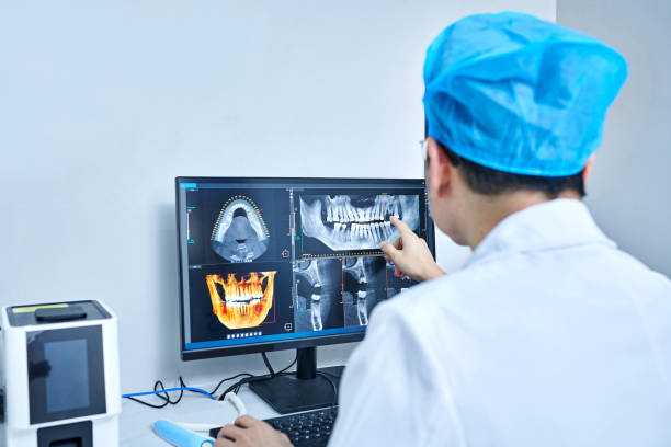 Best Broken or Cracked Tooth Emergency Dentist in Plattsburgh, NY